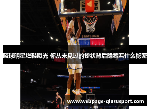 篮球明星烂鞋曝光 你从未见过的惨状背后隐藏着什么秘密